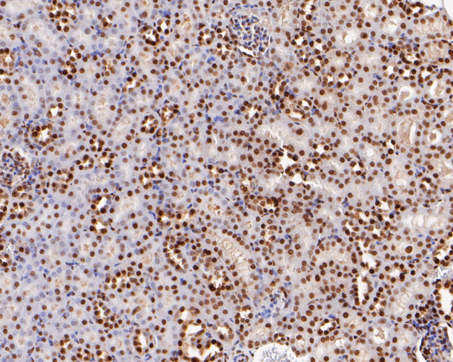 CtBP2 Antibody in Immunohistochemistry (Paraffin) (IHC (P))