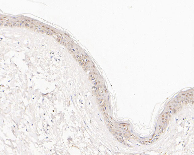 ABH1 Antibody in Immunohistochemistry (Paraffin) (IHC (P))