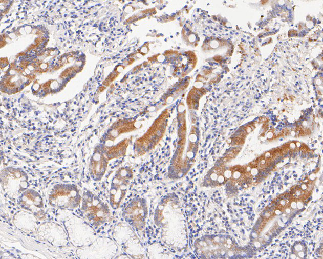 ABH1 Antibody in Immunohistochemistry (Paraffin) (IHC (P))