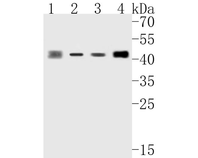 ABH1 Antibody in Western Blot (WB)