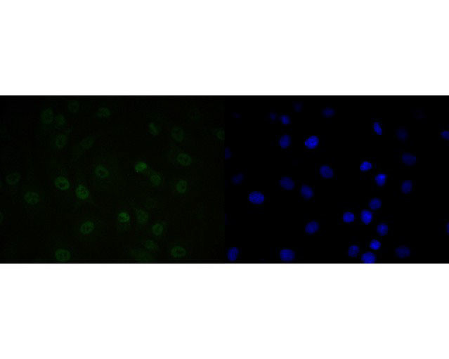 QKI Antibody in Immunocytochemistry (ICC/IF)