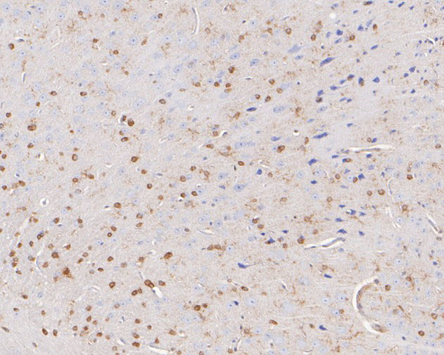 QKI Antibody in Immunohistochemistry (Paraffin) (IHC (P))