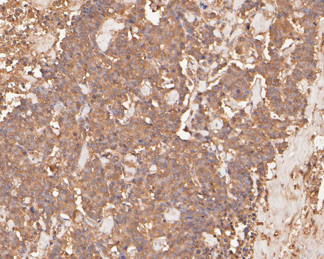 PAK1 Antibody in Immunohistochemistry (Paraffin) (IHC (P))