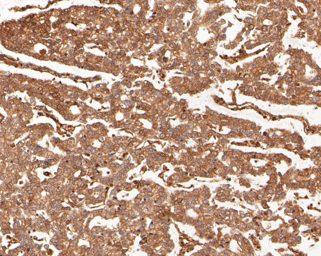 PAK1 Antibody in Immunohistochemistry (Paraffin) (IHC (P))