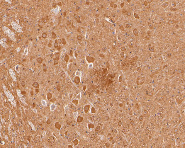 PAK1 Antibody in Immunohistochemistry (Paraffin) (IHC (P))