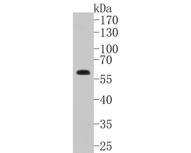 EIF2A Antibody in Western Blot (WB)