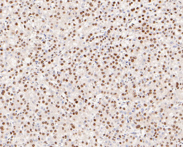 WDR4 Antibody in Immunohistochemistry (Paraffin) (IHC (P))