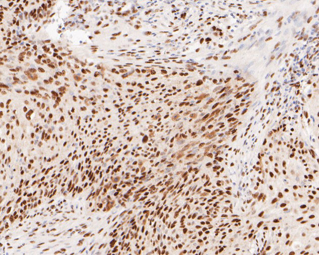 WDR4 Antibody in Immunohistochemistry (Paraffin) (IHC (P))