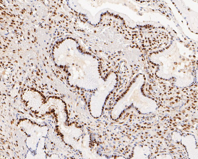 WDR4 Antibody in Immunohistochemistry (Paraffin) (IHC (P))