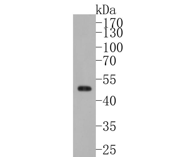 WDR4 Antibody in Western Blot (WB)