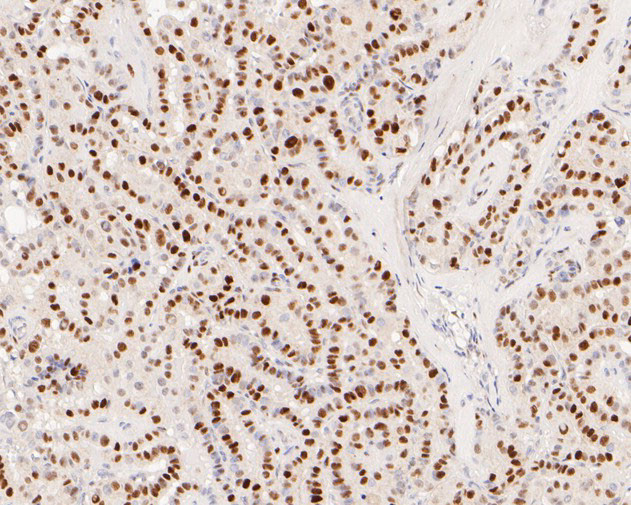 EGR1 Antibody in Immunohistochemistry (Paraffin) (IHC (P))