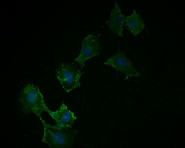 ACSL4 Antibody in Immunocytochemistry (ICC/IF)