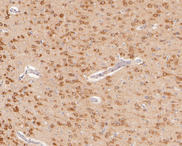 ACSL4 Antibody in Immunohistochemistry (Paraffin) (IHC (P))