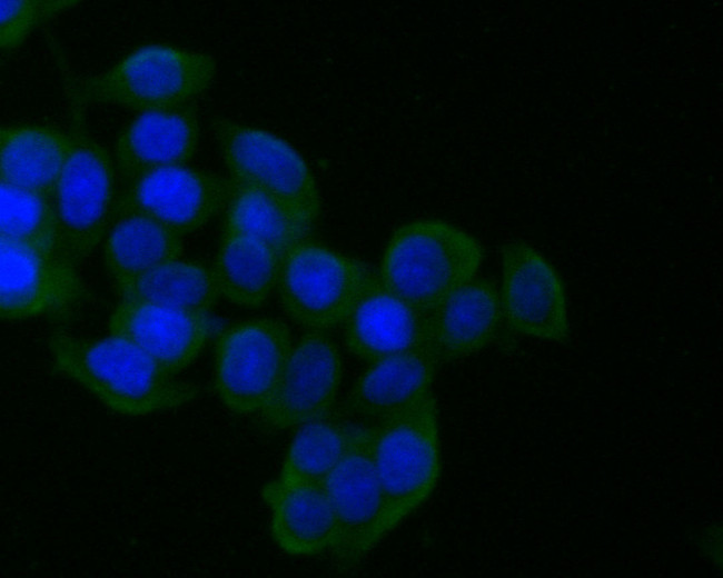 CD21 Antibody in Immunocytochemistry (ICC/IF)