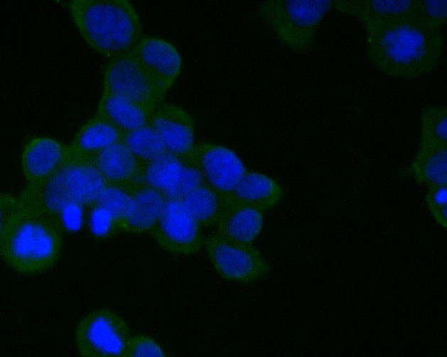 CD21 Antibody in Immunocytochemistry (ICC/IF)