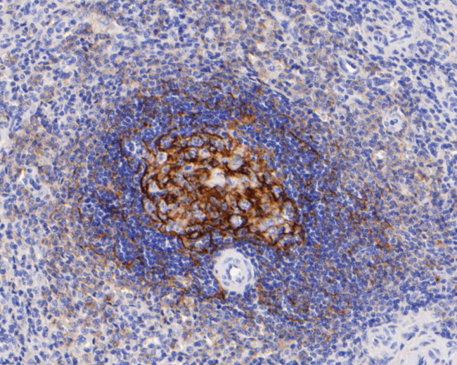 CD21 Antibody in Immunohistochemistry (Paraffin) (IHC (P))