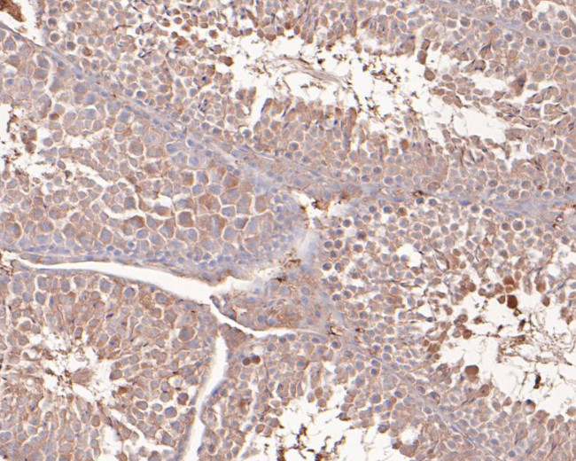 NSUN4 Antibody in Immunohistochemistry (Paraffin) (IHC (P))