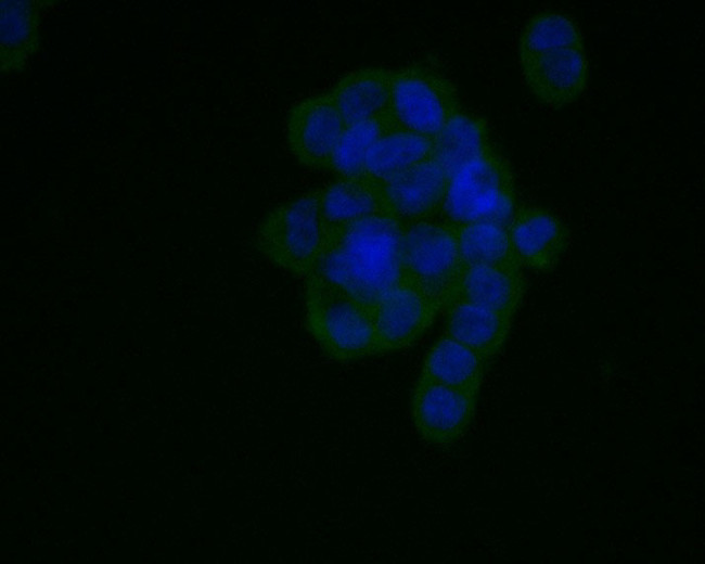 AGTR1 Antibody in Immunocytochemistry (ICC/IF)