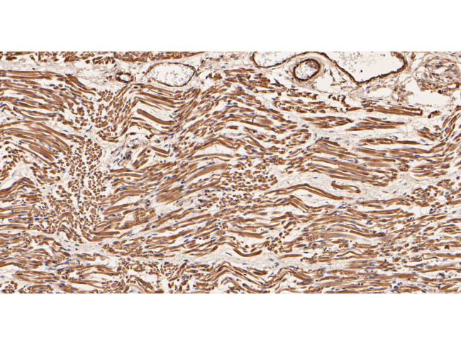 Actin Antibody in Immunohistochemistry (Paraffin) (IHC (P))