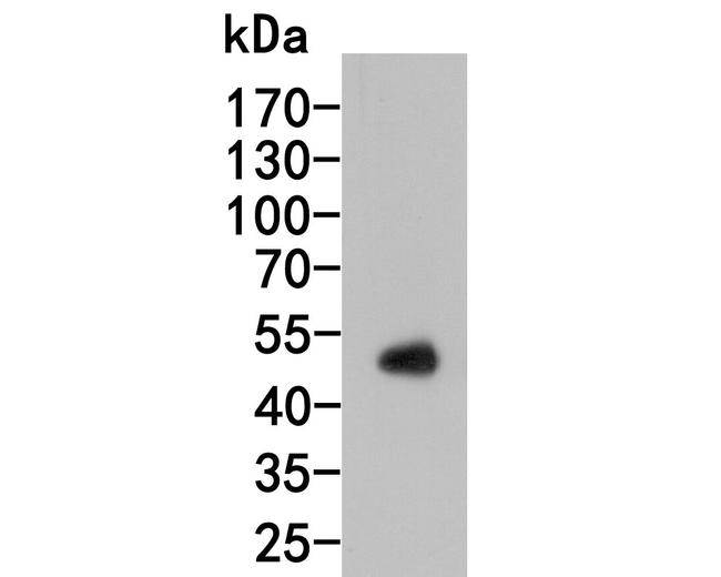 Thymidine Phosphorylase Antibody in Western Blot (WB)