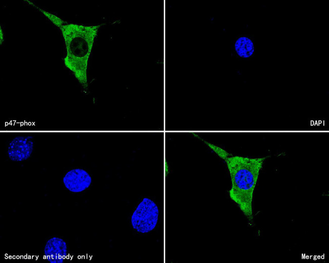 p47phox Antibody in Immunocytochemistry (ICC/IF)