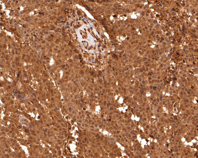 eIF6 Antibody in Immunohistochemistry (Paraffin) (IHC (P))