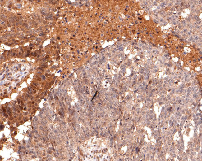 eIF6 Antibody in Immunohistochemistry (Paraffin) (IHC (P))