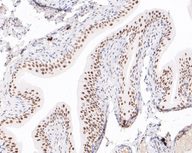 POLR2A Antibody in Immunohistochemistry (Paraffin) (IHC (P))