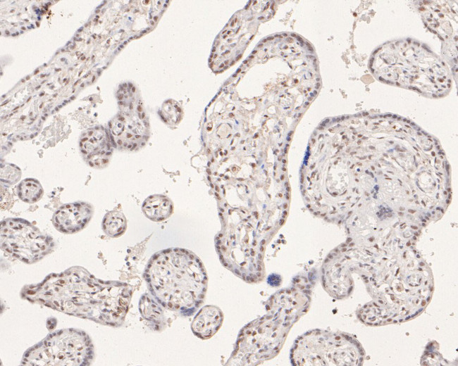 POLR2A Antibody in Immunohistochemistry (Paraffin) (IHC (P))