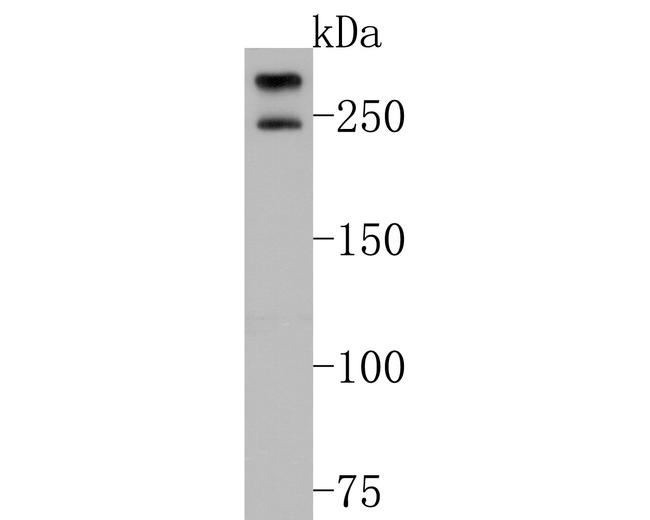 POLR2A Antibody in Western Blot (WB)