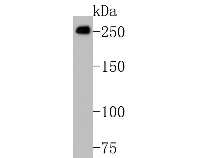 POLR2A Antibody in Western Blot (WB)