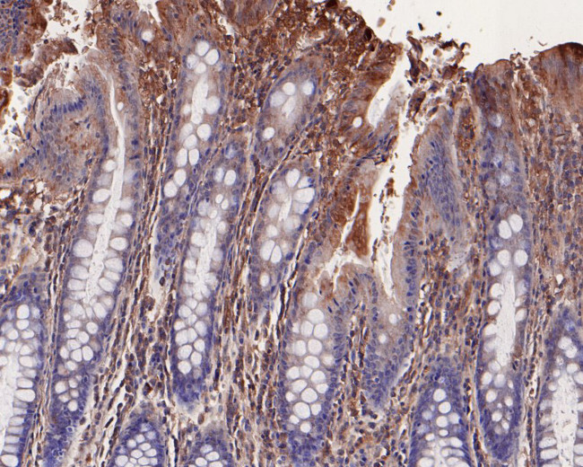 LRP6 Antibody in Immunohistochemistry (Paraffin) (IHC (P))