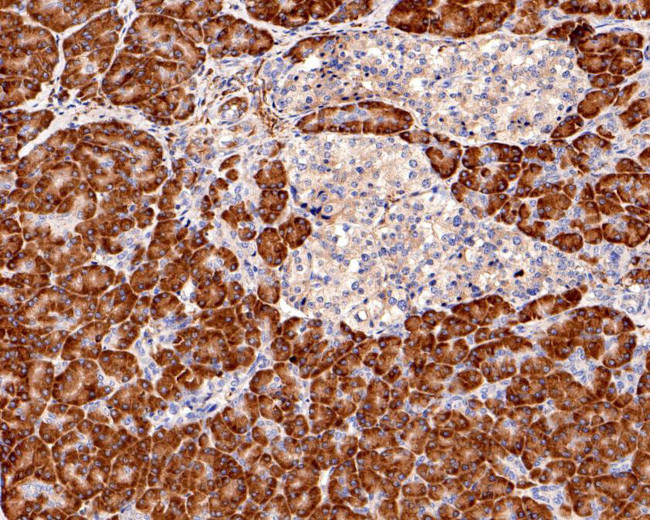 S6 Antibody in Immunohistochemistry (Paraffin) (IHC (P))