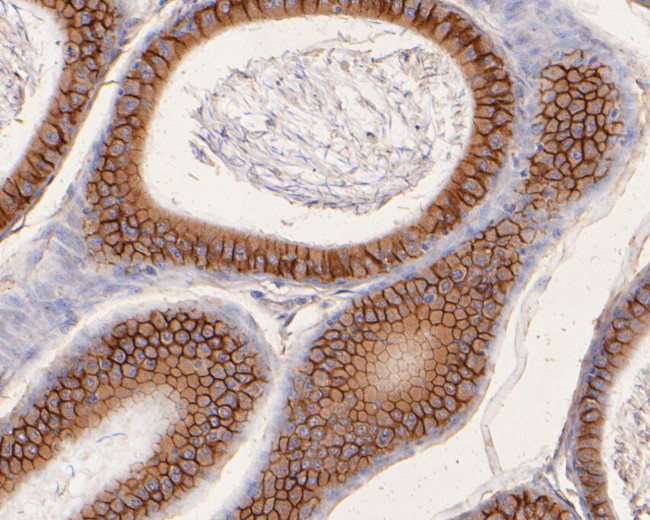 CD166 (ALCAM) Antibody in Immunohistochemistry (Paraffin) (IHC (P))