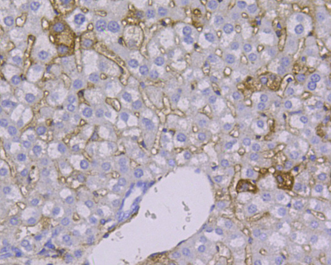 CD166 (ALCAM) Antibody in Immunohistochemistry (Paraffin) (IHC (P))