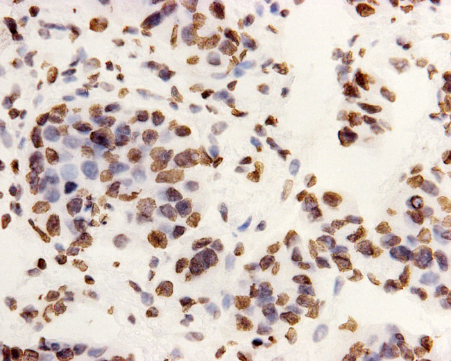 H3K9me3 Antibody in Immunohistochemistry (Paraffin) (IHC (P))