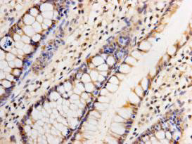 GATA4 Antibody in Immunohistochemistry (Paraffin) (IHC (P))