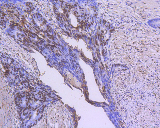 GATA4 Antibody in Immunohistochemistry (Paraffin) (IHC (P))