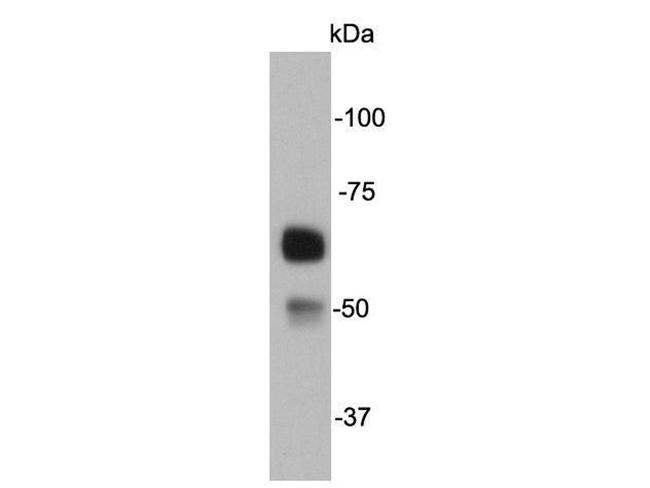 Catalase Antibody in Western Blot (WB)