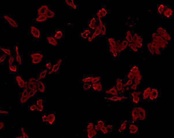 Cathepsin B Antibody in Immunocytochemistry (ICC/IF)