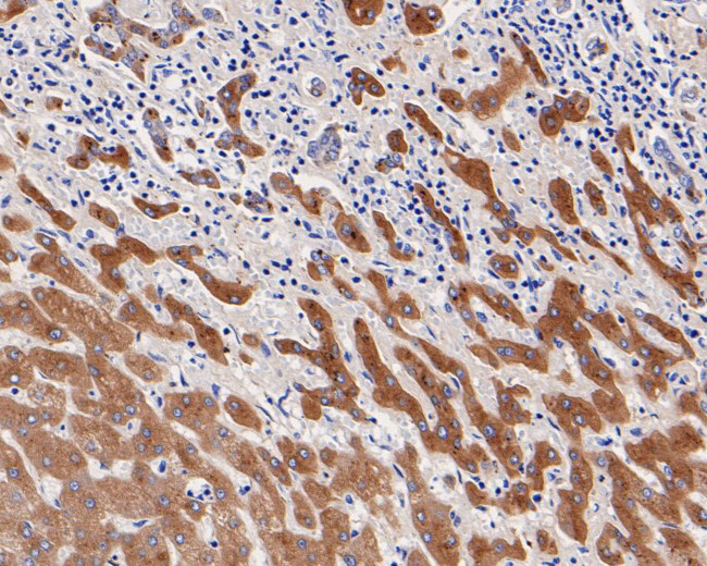 A2M Antibody in Immunohistochemistry (Paraffin) (IHC (P))