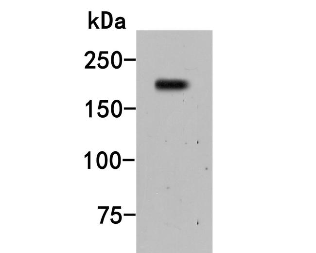 A2M Antibody in Western Blot (WB)