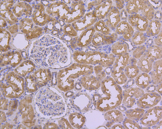 HDAC3 Antibody in Immunohistochemistry (Paraffin) (IHC (P))