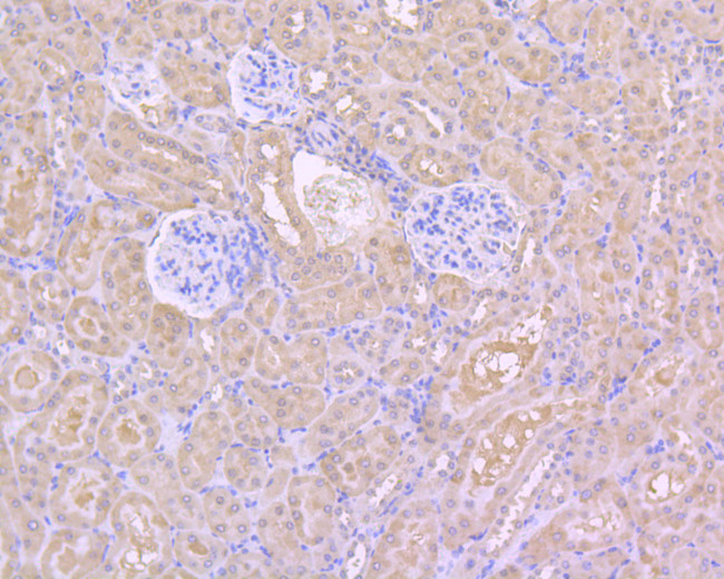 HDAC3 Antibody in Immunohistochemistry (Paraffin) (IHC (P))