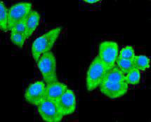 PTP1B Antibody in Immunocytochemistry (ICC/IF)