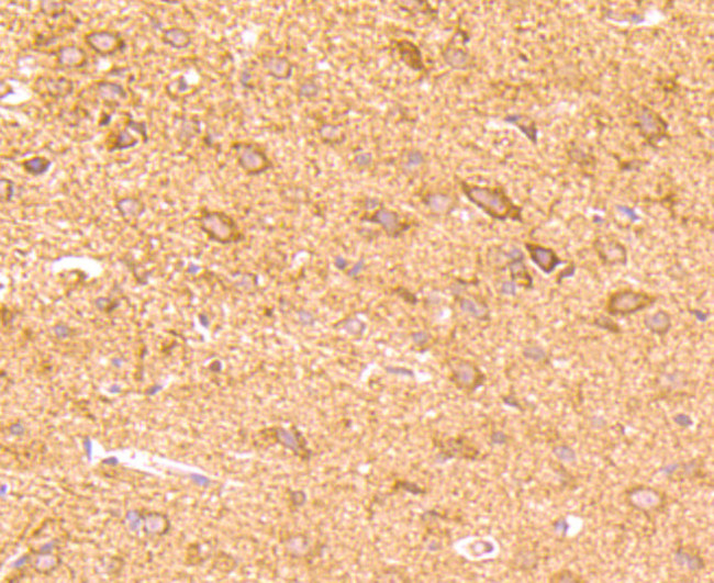 CD137 (4-1BB) Antibody in Immunohistochemistry (Paraffin) (IHC (P))