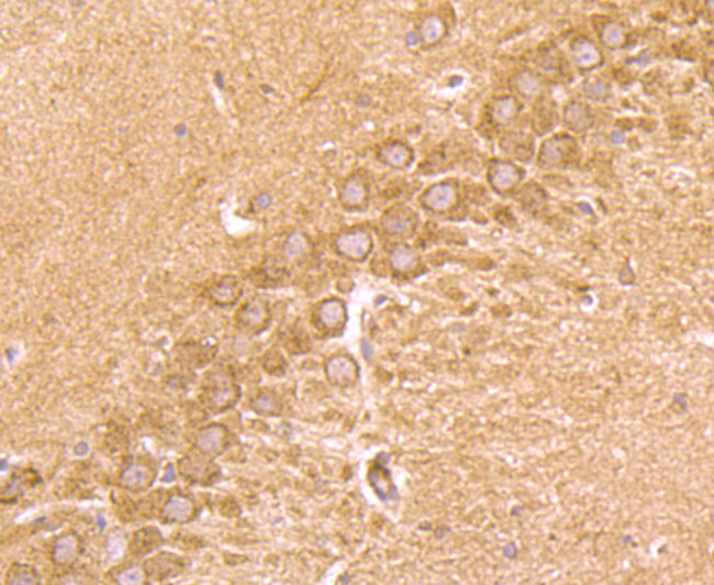 CD137 (4-1BB) Antibody in Immunohistochemistry (Paraffin) (IHC (P))