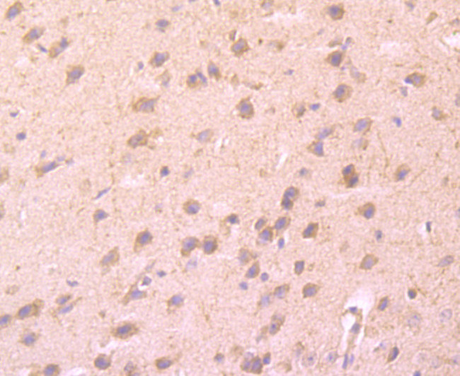 CD137 (4-1BB) Antibody in Immunohistochemistry (Paraffin) (IHC (P))