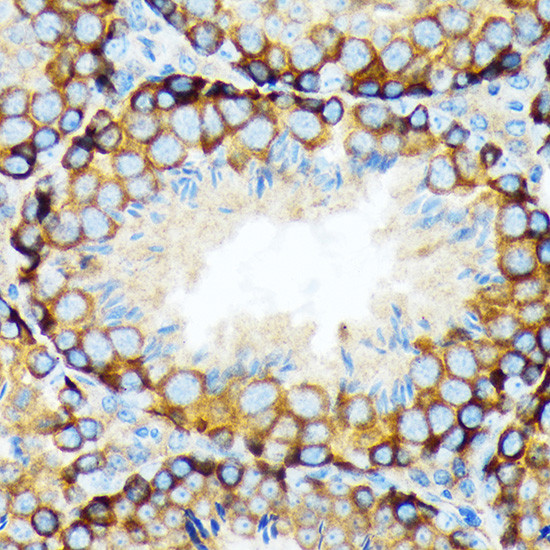 ELP3 Antibody in Immunohistochemistry (Paraffin) (IHC (P))