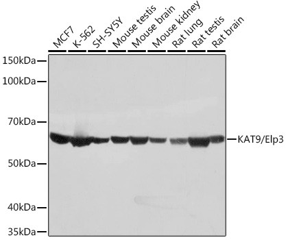 ELP3 Antibody in Western Blot (WB)